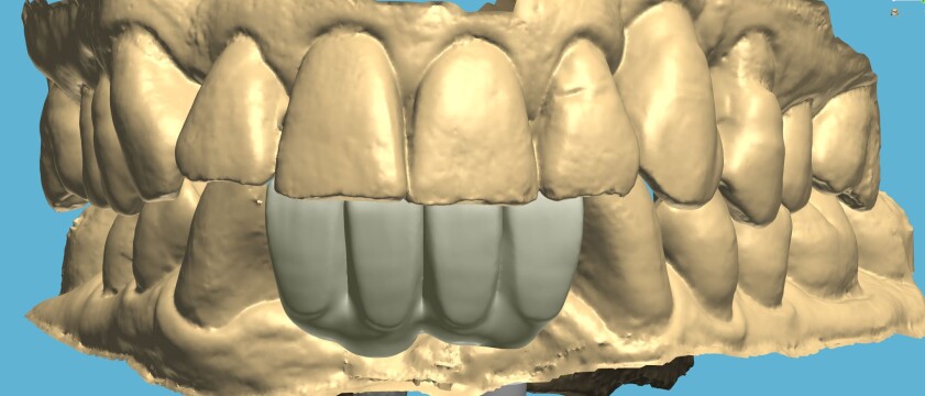Photo thumbnail