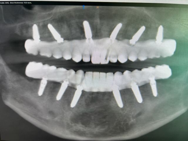 3D Printing case photo