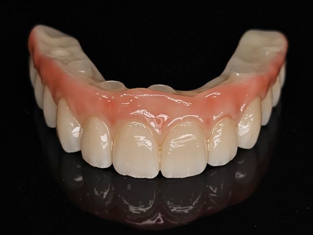 3D Printing case photo