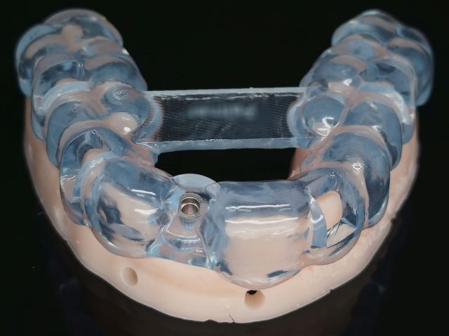 3D Printing case photo