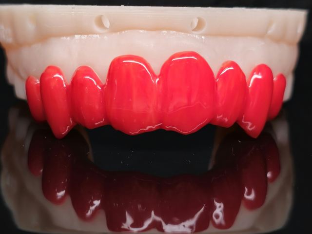 3D Printing case photo