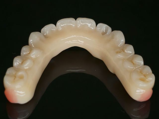 3D Printing case photo