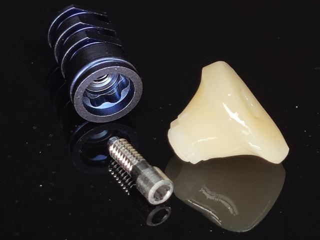 3D Printing case photo