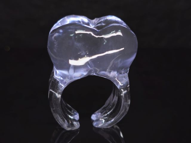 3D Printing case photo