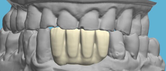 3Shape case photo