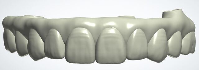 3Shape case photo