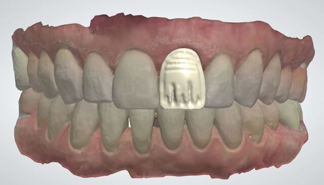 3Shape case photo