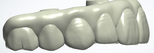 3Shape case photo