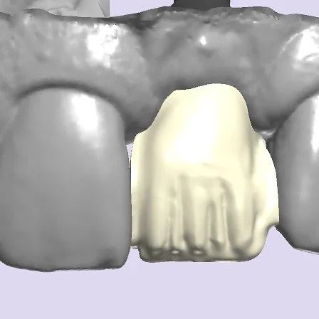 3Shape case photo