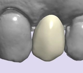 3Shape case photo