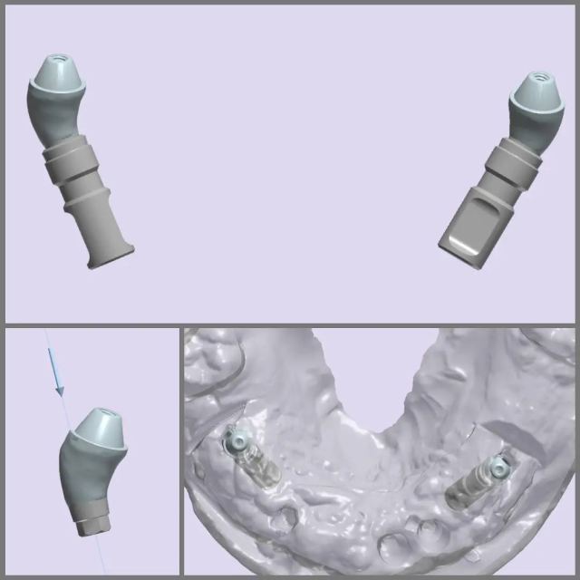 3Shape case photo