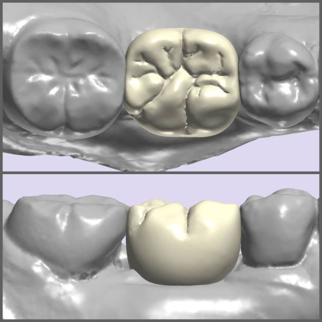 3Shape case photo