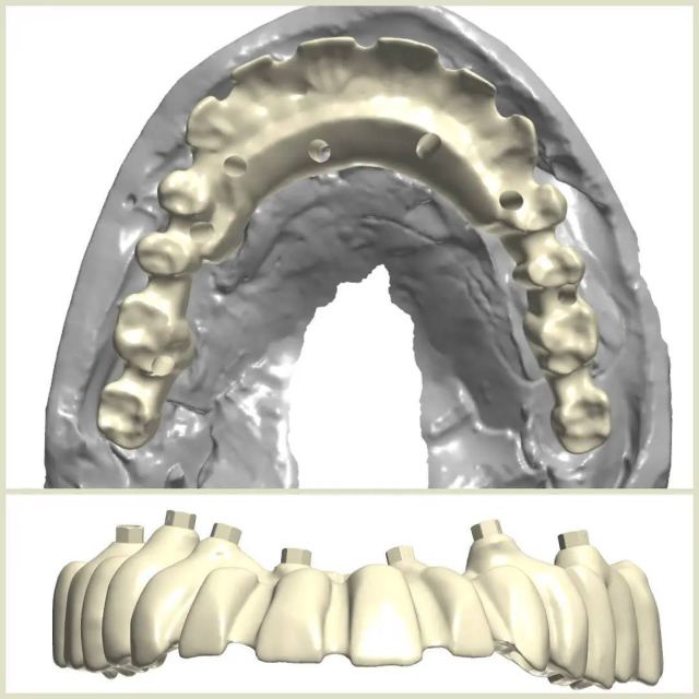 3Shape case photo