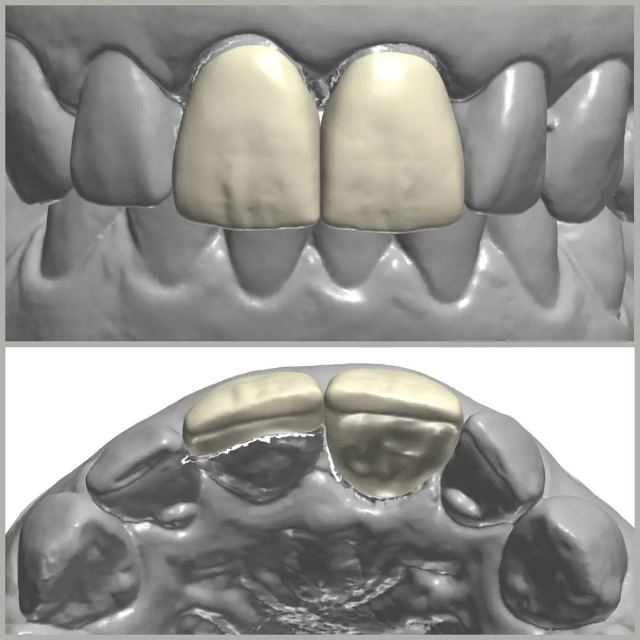 3Shape case photo