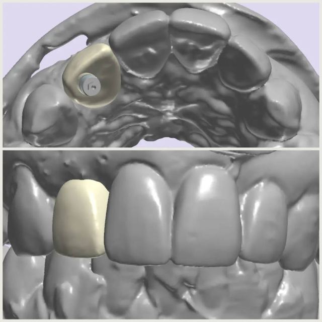 3Shape case photo