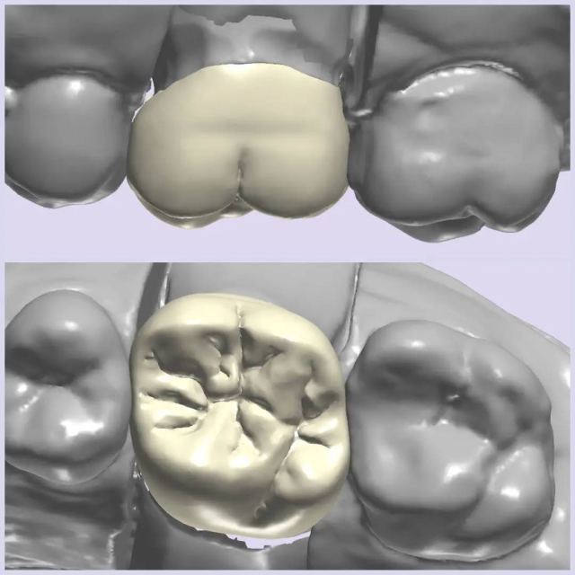 3Shape case photo