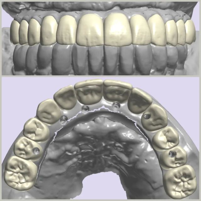 3Shape case photo