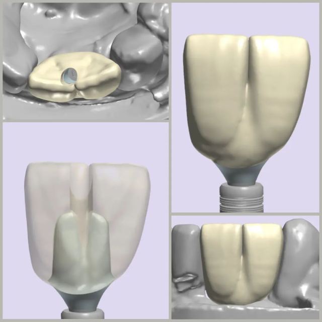 3Shape case photo