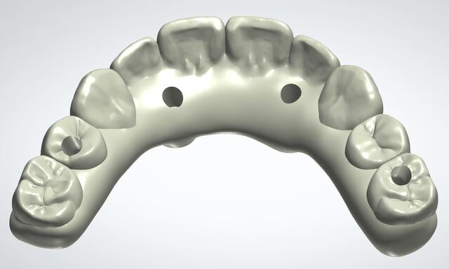 3Shape case photo