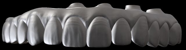 3Shape case photo