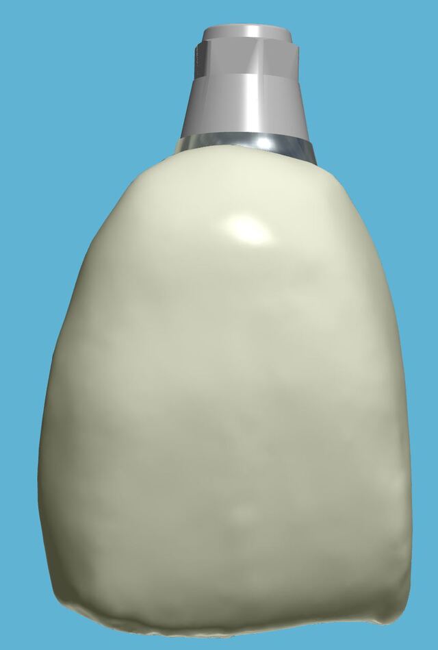 3Shape case photo