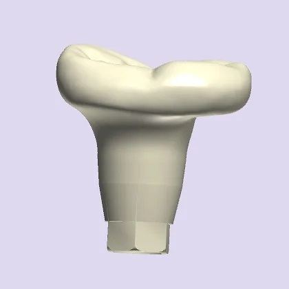 3Shape case photo
