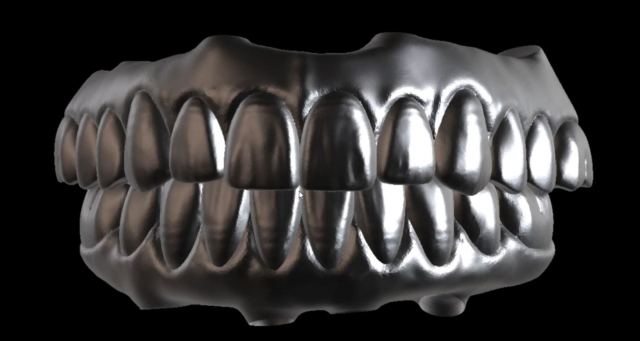 3Shape case photo