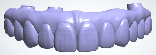 3Shape case photo
