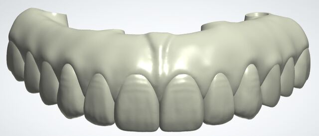 3Shape case photo