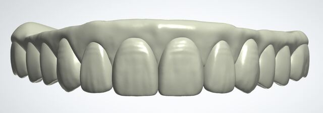 3Shape case photo