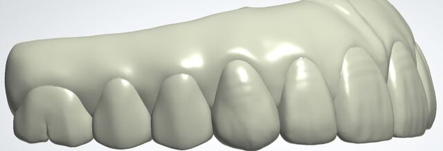 3Shape case photo