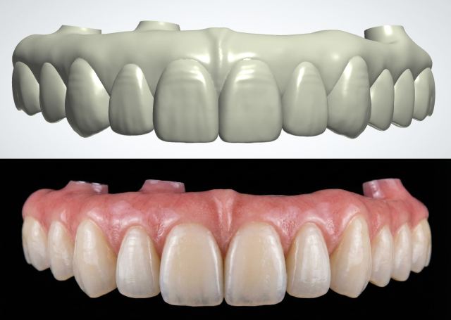 3Shape case photo