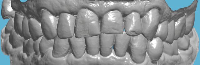 3Shape case photo