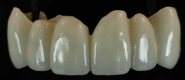 Milled case photo
